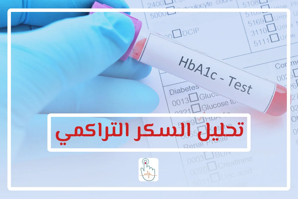 تحليل السكر التراكمي HbA1c
