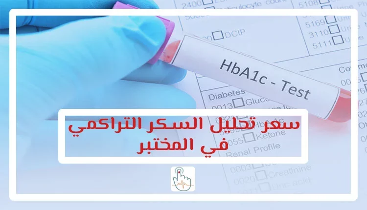 سعر تحليل السكر التراكمي في معمل المختبر 2022