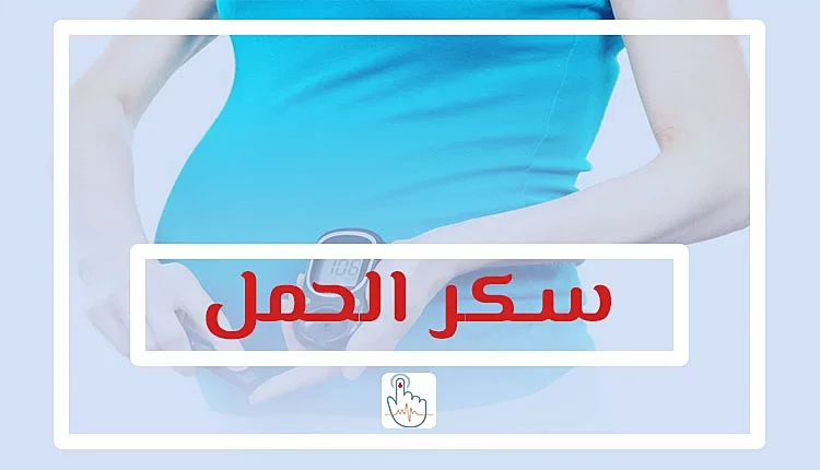 سكر الحمل
