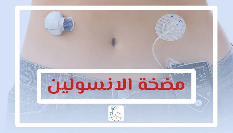 مضخة الانسولين
